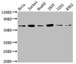 NUPL1 Antibody in Western Blot (WB)