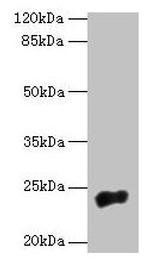 NACA2 Antibody in Western Blot (WB)