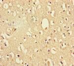 DHX35 Antibody in Immunohistochemistry (Paraffin) (IHC (P))