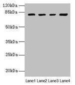 DHX35 Antibody in Western Blot (WB)