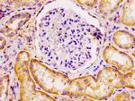 ECT2 Antibody in Immunohistochemistry (Paraffin) (IHC (P))