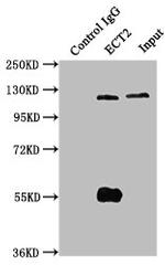 ECT2 Antibody in Immunoprecipitation (IP)