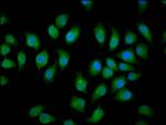 NEDL2 Antibody in Immunocytochemistry (ICC/IF)