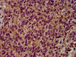 NEDL2 Antibody in Immunohistochemistry (Paraffin) (IHC (P))