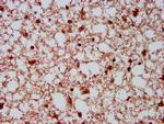 NEDL2 Antibody in Immunohistochemistry (Paraffin) (IHC (P))