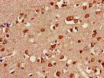 SHOC2 Antibody in Immunohistochemistry (Paraffin) (IHC (P))