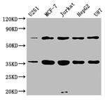 SHOC2 Antibody in Western Blot (WB)