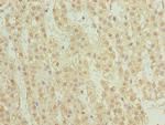 TRMT6 Antibody in Immunohistochemistry (Paraffin) (IHC (P))