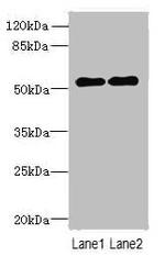 TRMT6 Antibody in Western Blot (WB)