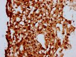 MKL2 Antibody in Immunohistochemistry (Paraffin) (IHC (P))