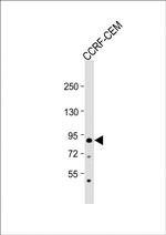 MDM2 Antibody in Western Blot (WB)