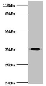 DIMT1 Antibody in Western Blot (WB)