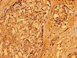 PACSIN3 Antibody in Immunohistochemistry (Paraffin) (IHC (P))