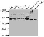 NOB1 Antibody in Western Blot (WB)