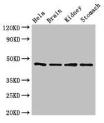 NOB1 Antibody in Western Blot (WB)