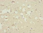 CEP83 Antibody in Immunohistochemistry (Paraffin) (IHC (P))