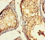 Actin-like 7A Antibody in Immunohistochemistry (Paraffin) (IHC (P))