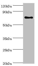 SLC27A6 Antibody in Western Blot (WB)