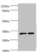 ORNT1 Antibody in Western Blot (WB)