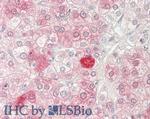 TIP60 Antibody in Immunohistochemistry (Paraffin) (IHC (P))