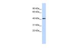 PARP11 Antibody in Western Blot (WB)