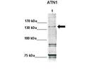 Atrophin 1 Antibody in Western Blot (WB)