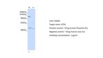 Atrophin 1 Antibody in Western Blot (WB)