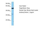 RAR gamma-1 Antibody in Western Blot (WB)