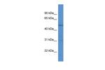 RAR gamma-1 Antibody in Western Blot (WB)