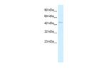 RNF36 Antibody in Western Blot (WB)