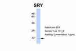 SRY Antibody in Western Blot (WB)