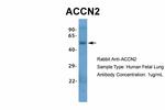 ASIC1 Antibody in Western Blot (WB)