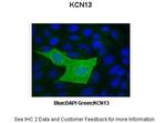 KCNK13 Antibody in Immunocytochemistry (ICC/IF)