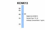 KCNK13 Antibody in Western Blot (WB)