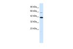 KCNK13 Antibody in Western Blot (WB)