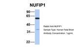 NUFIP1 Antibody in Western Blot (WB)