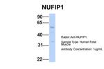 NUFIP1 Antibody in Western Blot (WB)