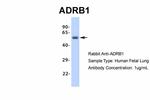 beta-1 Adrenergic Receptor Antibody in Western Blot (WB)