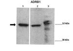 beta-1 Adrenergic Receptor Antibody in Western Blot (WB)