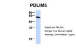 PDLIM5 Antibody in Western Blot (WB)