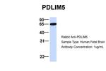 PDLIM5 Antibody in Western Blot (WB)