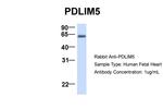 PDLIM5 Antibody in Western Blot (WB)