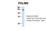 PDLIM5 Antibody in Western Blot (WB)