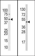 SUV39H2 Antibody in Western Blot (WB)