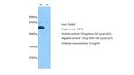 HBP1 Antibody in Western Blot (WB)