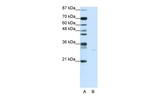 AIF Antibody in Western Blot (WB)