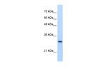 PSMA1 Antibody in Western Blot (WB)