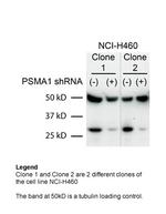 PSMA1 Antibody in Western Blot (WB)