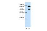 SNRNP70 Antibody in Western Blot (WB)