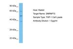 SNRNP70 Antibody in Western Blot (WB)